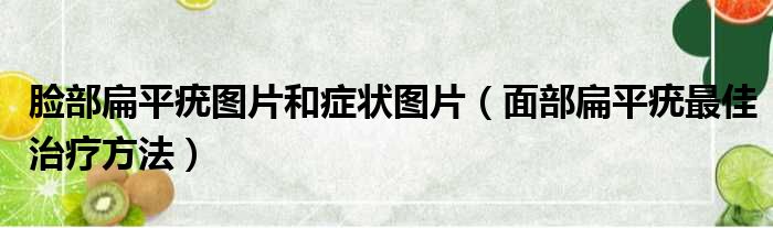 脸部扁平疣图片和症状图片（面部扁平疣最佳治疗方法）